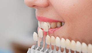 upper east side veneers and bonding cosmetic dentist