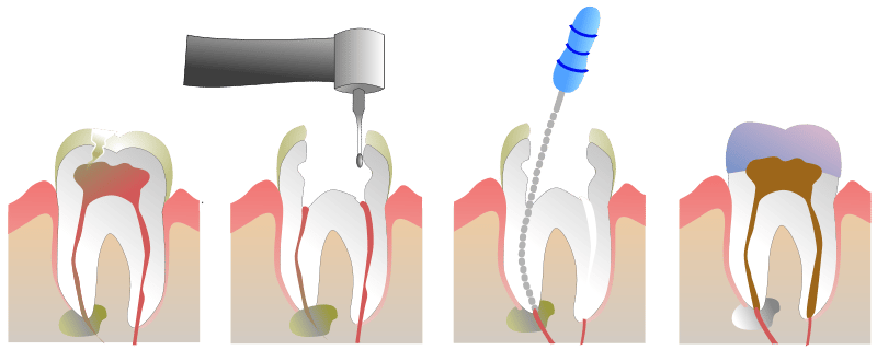 Upper East Side Cosmetic Dentistry