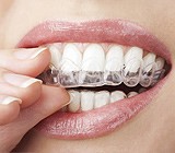 lenox hill invisalign