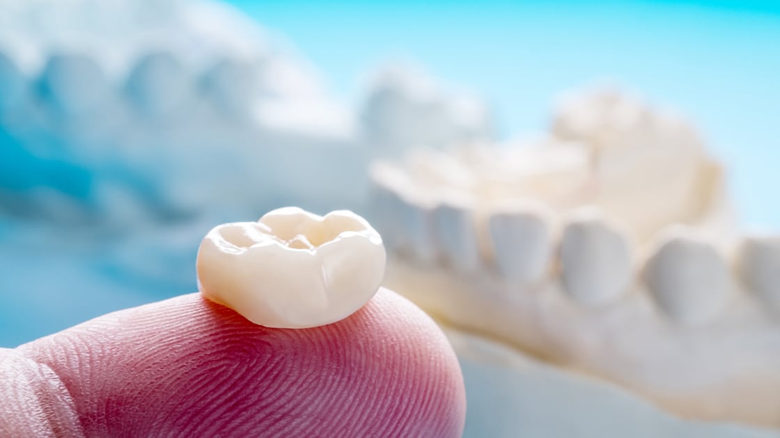 Dental Crown Image