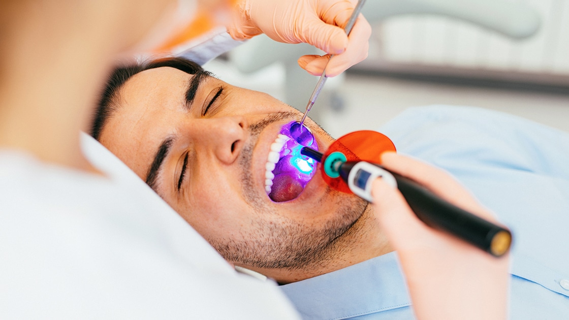 Man getting Procedure Dental Sealants