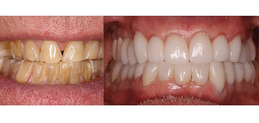 case study before and after 14