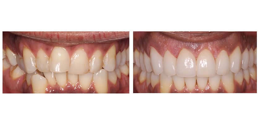 case study before and after 13