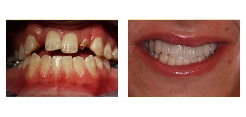 case study before and after 6