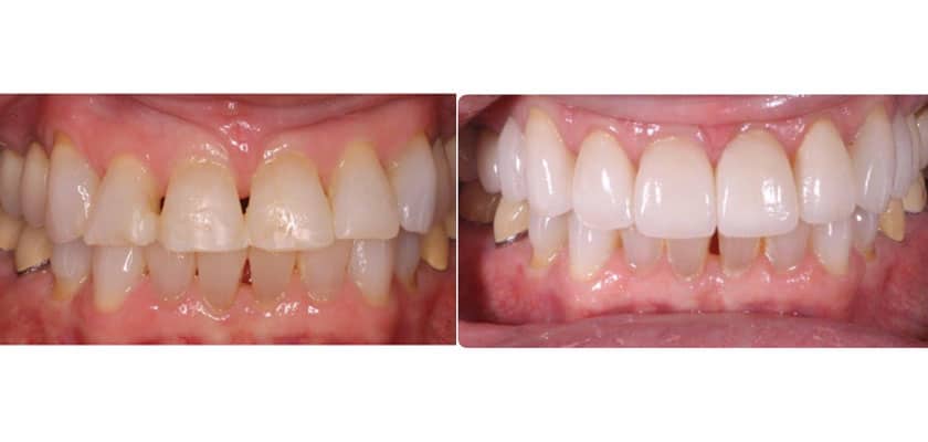 case study before and after 4