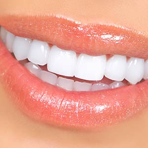 manhattan cosmetic dentist veneers near me