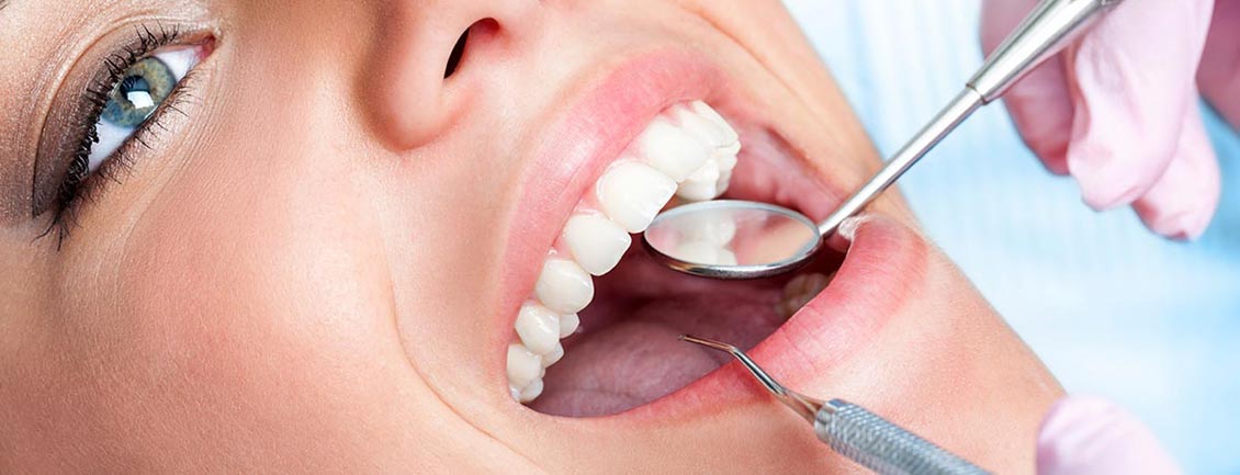upper east side smile makeover