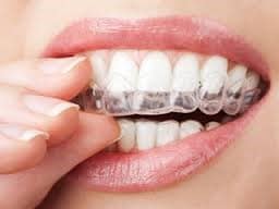 tribeca invisalign